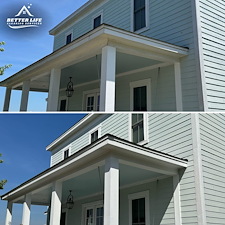 Before-and-After 15